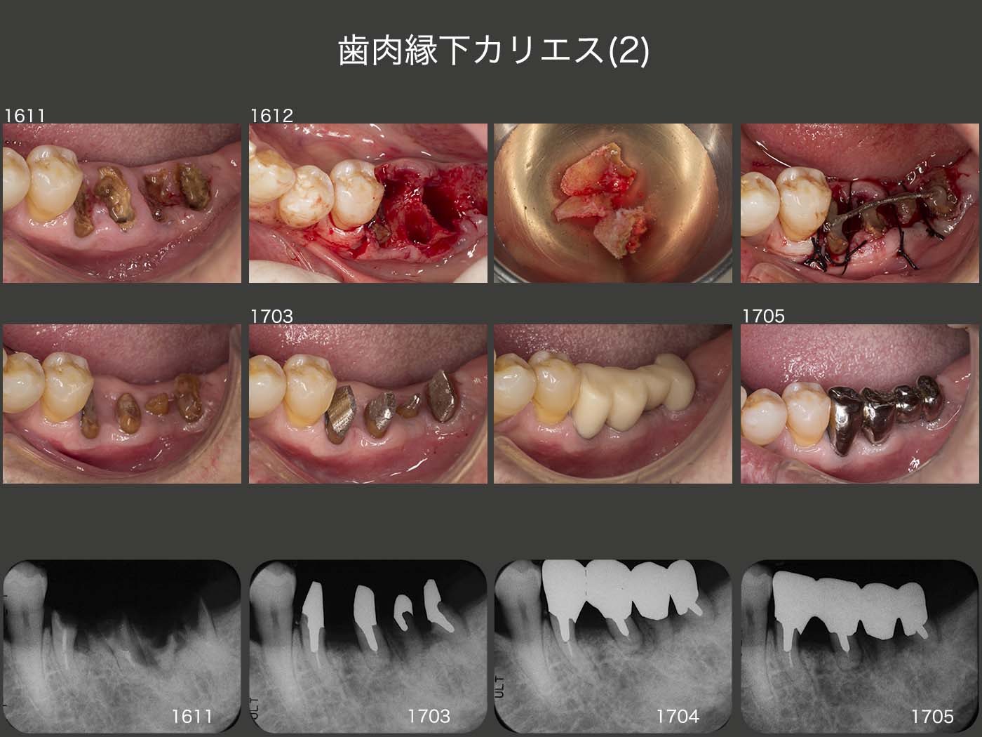 歯の再植診療科目